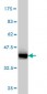 KRT4 Antibody (monoclonal) (M01)
