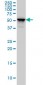 KRT4 Antibody (monoclonal) (M01)