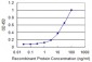 KRT5 Antibody (monoclonal) (M08)