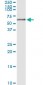 KRT5 Antibody (monoclonal) (M08)