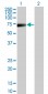 KRT5 Antibody (monoclonal) (M08)