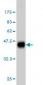 KSR2 Antibody (monoclonal) (M08)