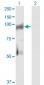 KSR2 Antibody (monoclonal) (M08)