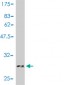 LAMC1 Antibody (monoclonal) (M01)