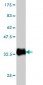 LASS6 Antibody (monoclonal) (M01)