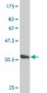 LASS6 Antibody (monoclonal) (M02)