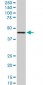 LASS6 Antibody (monoclonal) (M02)