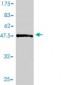 LAT Antibody (monoclonal) (M01)