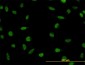 LDB2 Antibody (monoclonal) (M01)