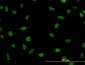 LDB2 Antibody (monoclonal) (M01)