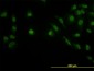 LDB2 Antibody (monoclonal) (M02)