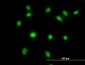 LDB2 Antibody (monoclonal) (M03)