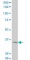 LDB3 Antibody (monoclonal) (M06)