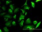 LDHB Antibody (monoclonal) (M01)