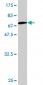 LDHB Antibody (monoclonal) (M01)