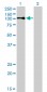 LDLR Antibody (monoclonal) (M01)