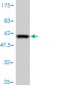 LDLRAP1 Antibody (monoclonal) (M01)
