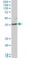 LFNG Antibody (monoclonal) (M03)