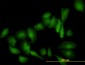 LGALS1 Antibody (monoclonal) (M01)