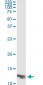 LGALS1 Antibody (monoclonal) (M01)