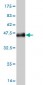 LGALS1 Antibody (monoclonal) (M01)