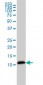 LGALS1 Antibody (monoclonal) (M01)