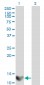 LGALS1 Antibody (monoclonal) (M01)