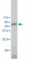 LGALS8 Antibody (monoclonal) (M01)