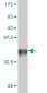 LGR7 Antibody (monoclonal) (M01)