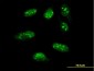 LHX1 Antibody (monoclonal) (M01)