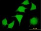 LIMK2 Antibody (monoclonal) (M01)