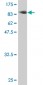 LIMK2 Antibody (monoclonal) (M01)