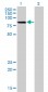 LIMK2 Antibody (monoclonal) (M01)