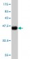LMO2 Antibody (monoclonal) (M02)