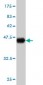 LMO2 Antibody (monoclonal) (M02)