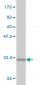 LMO3 Antibody (monoclonal) (M04)