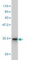 LMO3 Antibody (monoclonal) (M08)