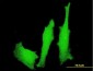 LMO4 Antibody (monoclonal) (M01)