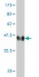 LMO4 Antibody (monoclonal) (M01)