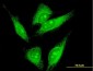 LMO7 Antibody (monoclonal) (M01)