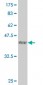 LMTK3 Antibody (monoclonal) (M02)