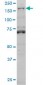 LMTK3 Antibody (monoclonal) (M02)