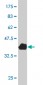 LMTK3 Antibody (monoclonal) (M03)