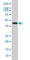 LW-1 Antibody (monoclonal) (M01)