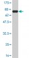 LW-1 Antibody (monoclonal) (M02)