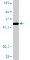 MAD2L1BP Antibody (monoclonal) (M03)