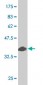 MAK Antibody (monoclonal) (M01)