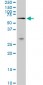 MAK Antibody (monoclonal) (M01)