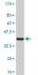 MAK Antibody (monoclonal) (M02)