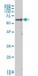 MAK Antibody (monoclonal) (M02)